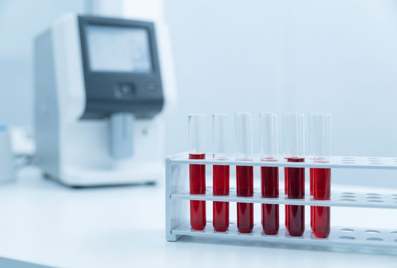 Blutproben im Laborständer
